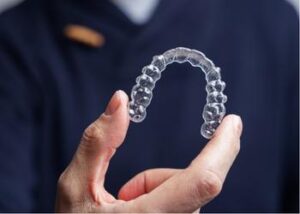 invisalign - aparelho - transparente